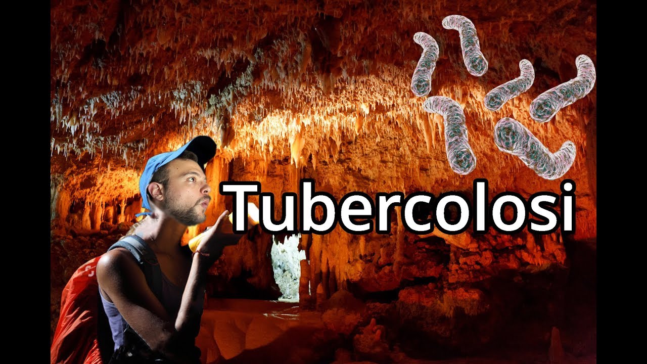 TUBERCOLOSI: Una malattia tanto antica quanto moderna - Spiegazione