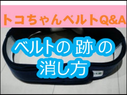 トコちゃんベルトの跡の消し方 よくある質問にお答えしました ｑ ａ Youtube