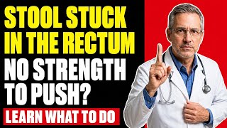 STOOL STUCK in the RECTUM After 60! What It Is and What To Do IMMEDIATELY