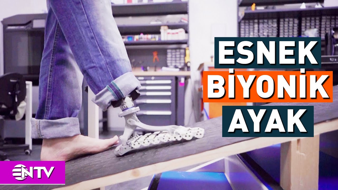 Ayak Protezinde Devrim! Biyonik Ayak Üretildi | NTV