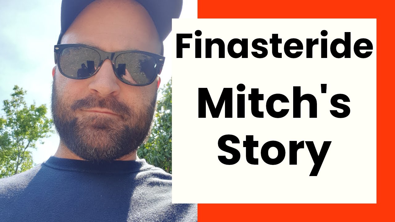 Постфинастеридный синдром: история Митча