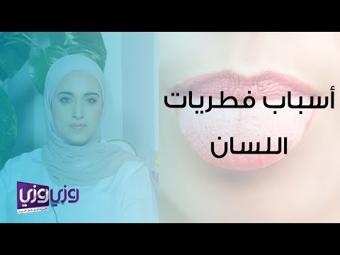 أسباب فطريات اللسان