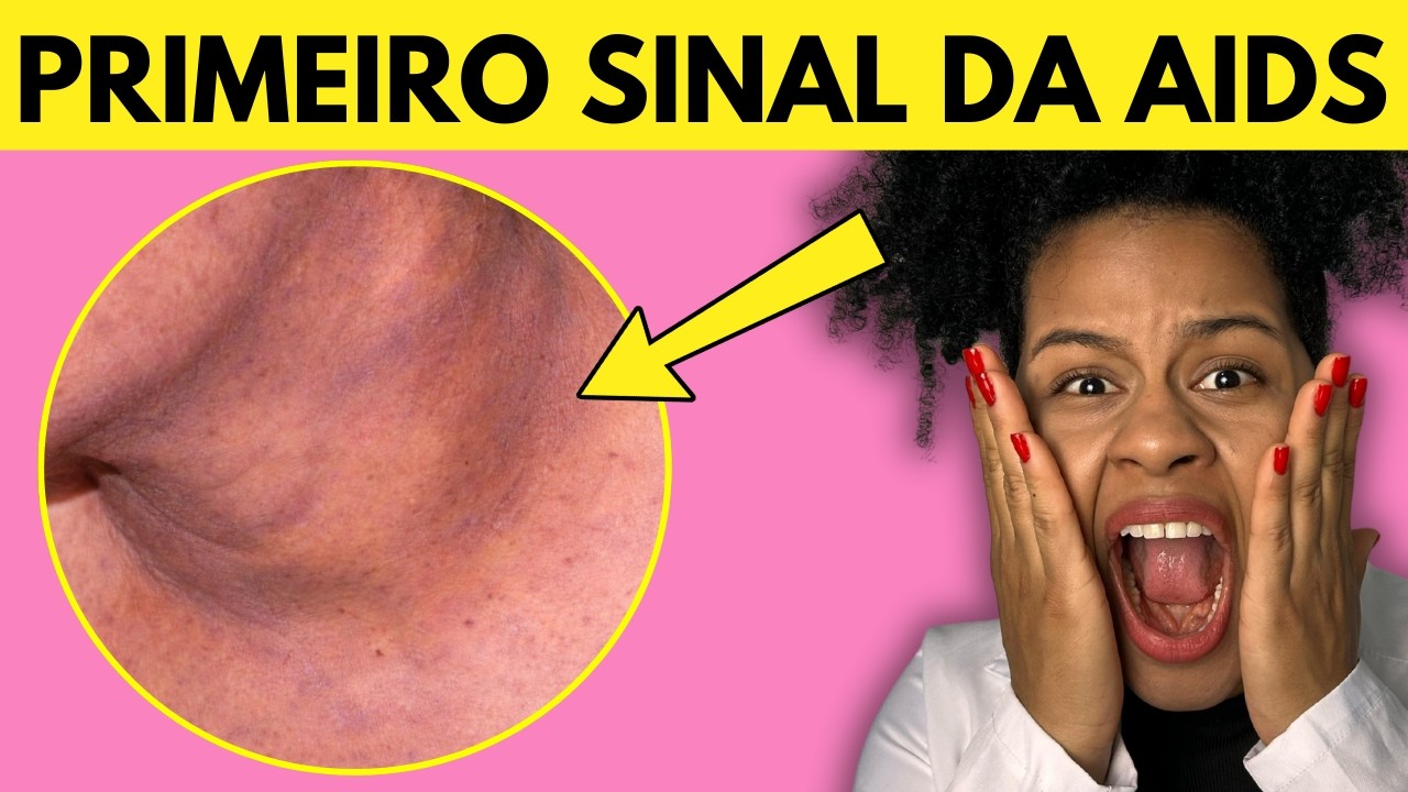 8 Sinais de AIDS que você consegue VER e ignora