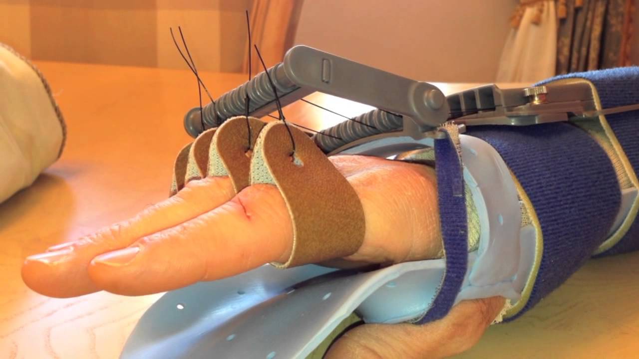 DiLoTrax Extensor Tendon Repair Tutorial YouTube