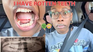 I HAVE ROTTEN TEETH | 1ST DENTAL APPOINTMENT IN OVER 15 YEARS | VENEERS, PARTIALS, DENTURES?!! 🤢😷💀