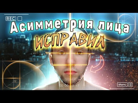 Как исправить асимметрию лица? Мой опыт, как я убрал асимметрию лица?