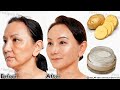 Japanese secret to looking 10 years younger than your age 🌾 it removes wrinkles and pigmentation