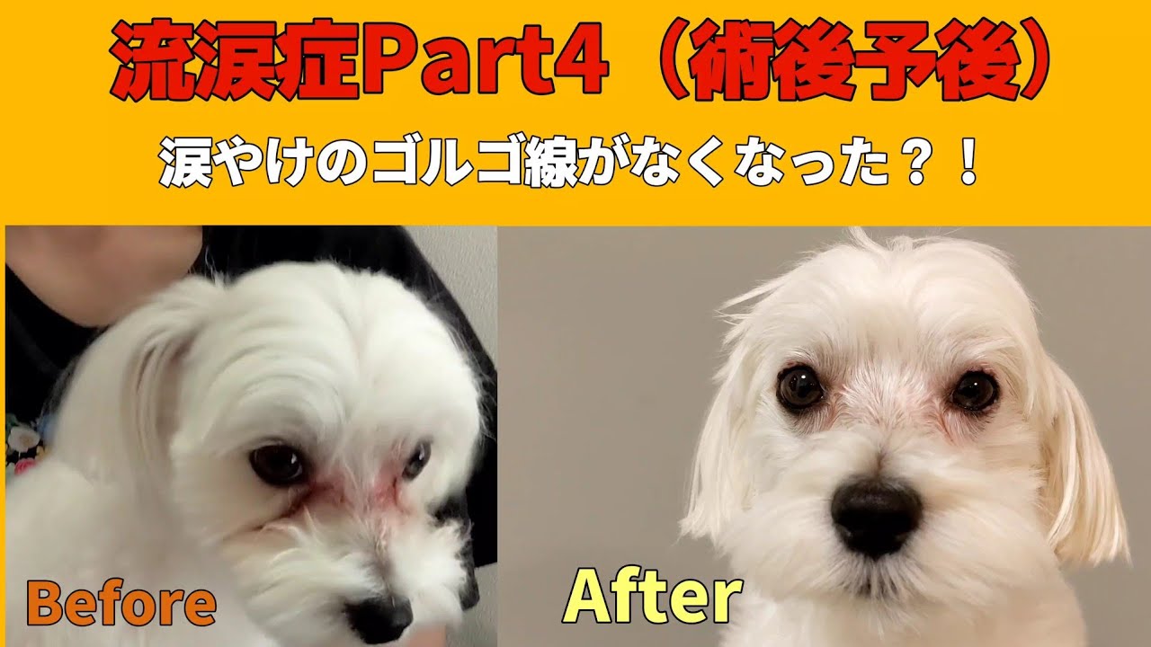 涙やけの術後予後（流涙症治療）Part4