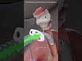 Tracheotomy procedure #motivation #doctor #epicmusicword