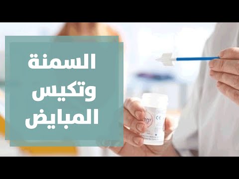 ما العلاقة بين السمنة و تكيس المبايض