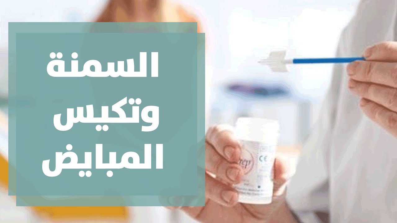 ما العلاقة بين السمنة و تكيس المبايض؟