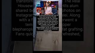 Denise Richards stunned fans with her 'drop dead gorgeous' facelift transformation.#ytshorts
