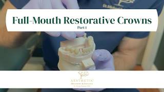 Full Mouth Restorative Crown Case