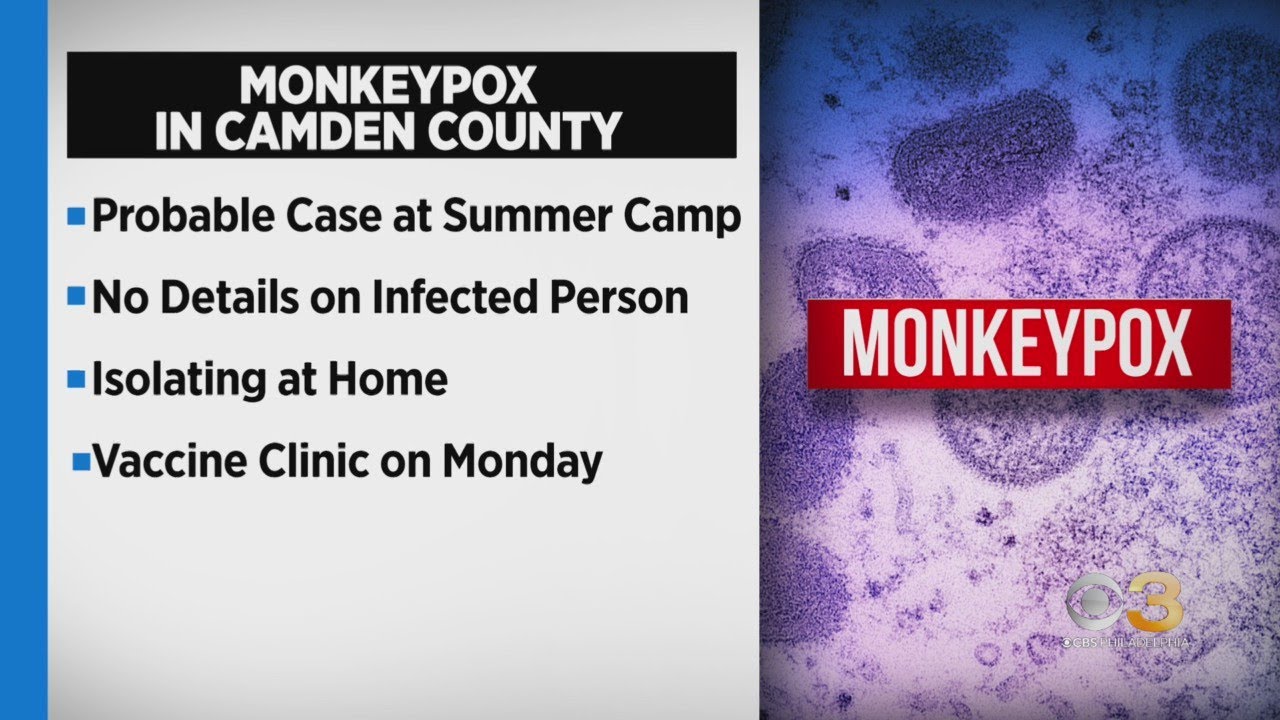 Probable monkeypox case identified at Camden County summer camp - YouTube