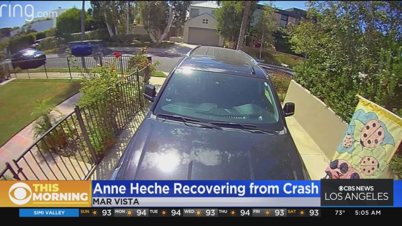 Actress Anne Heche recovering in ICU following Mar Vista crash