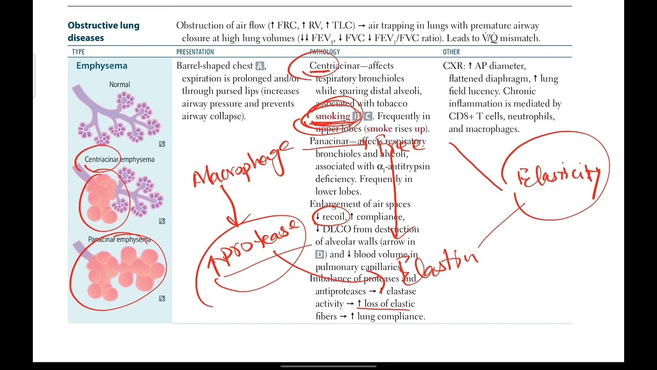 Emphysema Respiratory 16 First Aid USMLE Step 1 YouTube Emphysema Respiratory 16 First Aid USMLE Step 1 YouTube