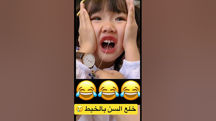 خلع السن بالخيط 🥲 #short