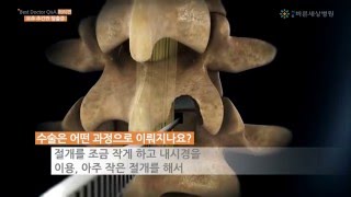 서울바른세상병원  ㅣ  요추추간판탈출증  강지훈 원장