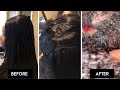 NATURAL HAIR HORROR STORY! I can't even BELIEVE this! I GOT A SCALP INFECTION