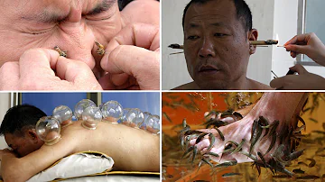 Weird Asian Folk Remedies to Improve Your Health