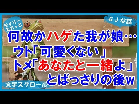 【スカッとする話 GJ】何故かハゲた我が娘…ウト「なんでこんな可愛くないんだ？」トメ「あなたと一緒よ」とばっさりの後・・・【デイリー スカッと】