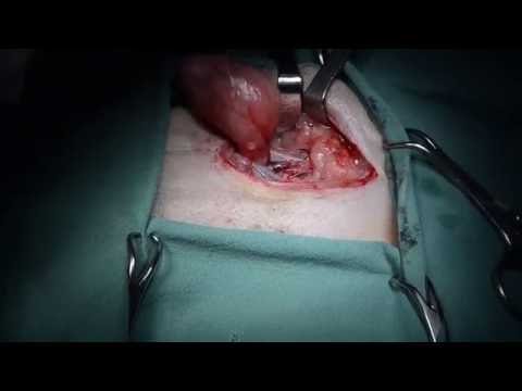 Vídeo: Dog Hernia - Hérnia Inguinal Em Cães - O Que é Uma Hérnia?