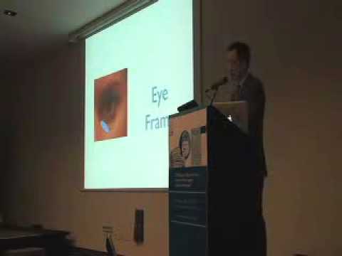 Fat Grafting: How I Do It, VII Intl Congress of Facial Plastic Surgery, May 10, 2012, Rome, Italy