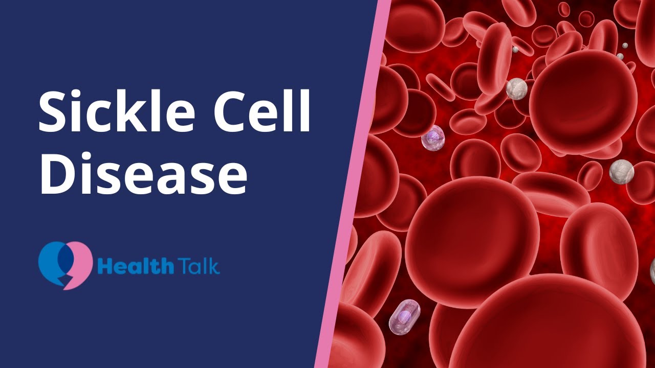 Sickle Cell Disease