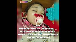 Bantu Lula Sembuh Dari Bernard Soulier Syndrome