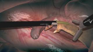 LapVR Interventional Simulator by CAE Healthcare