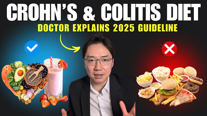 Crohn’s & Colitis Diet: New ECCO 2025 Guidelines Explained