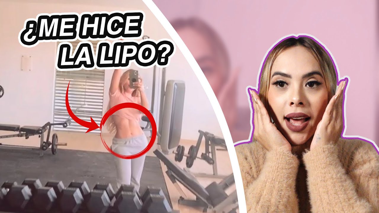 ¿ME HICE LA LIPO? Respondo a todo p1 - YouTube