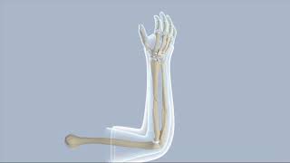 Closed Reduction of a Forearm Fracture