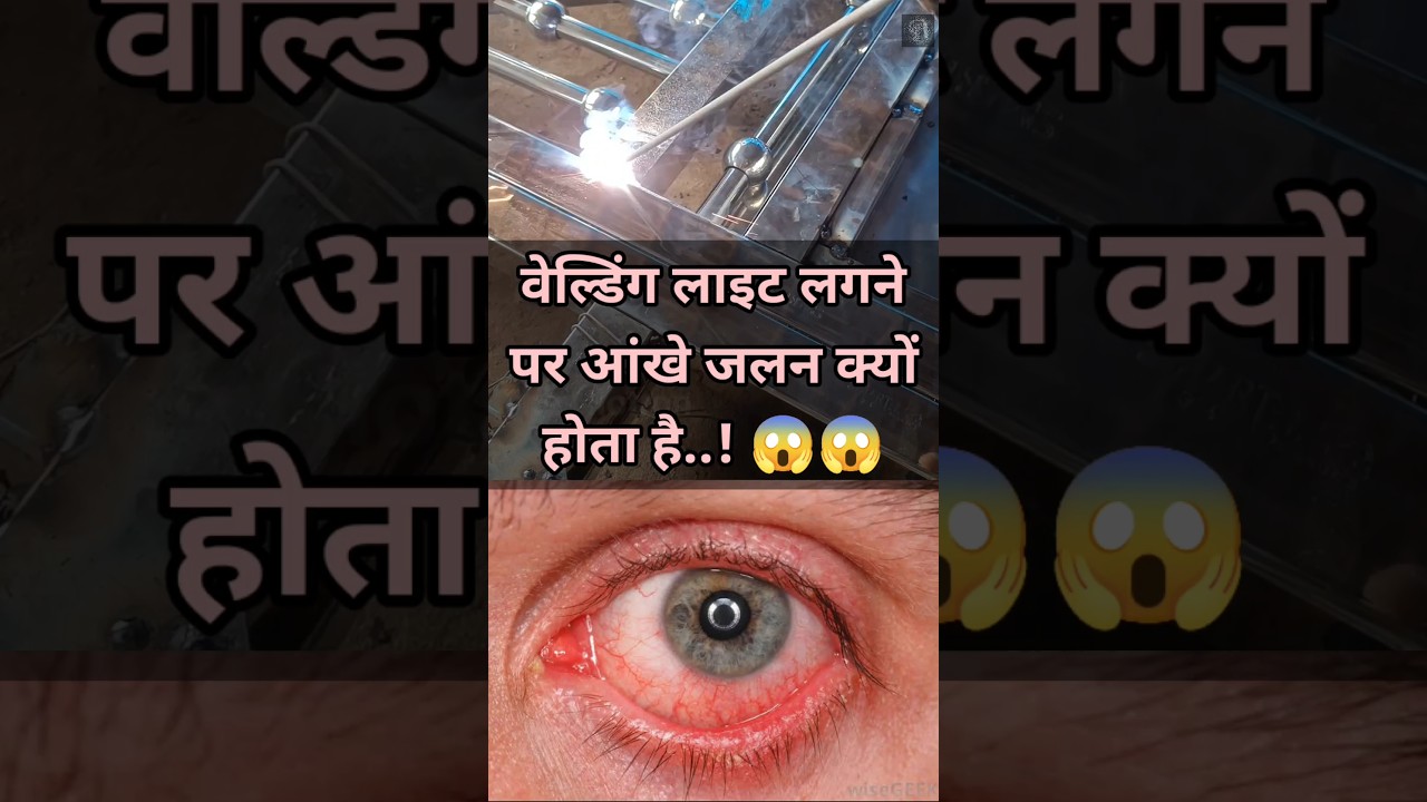 वेल्डिंग लगने से आंखें जलन क्यों होता है😱 #welding #weldinglight