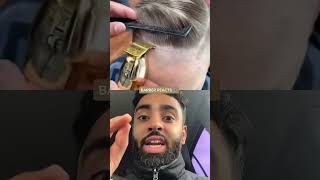 Wow Worst Hairline Ever? Barber Reacts To This Haircut