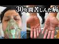 30年以上苦しんだ病を治す大手術してきました【多汗症】
