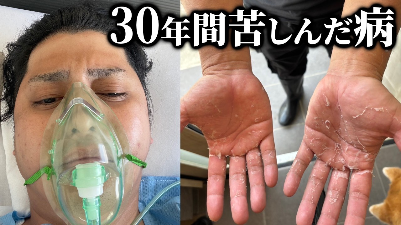 30年以上苦しんだ病を治す大手術してきました【多汗症】