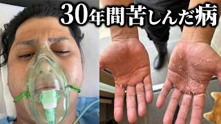 30年以上苦しんだ病を治す大手術してきました【多汗症】