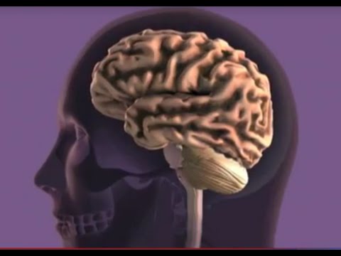 تصویری: آیا آلزایمر درمان شده است؟