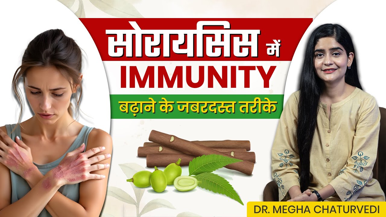 सोरायसिस में Immunity बढ़ाने के जबरदस्त तरीके | Tips to Boost Your Immunity