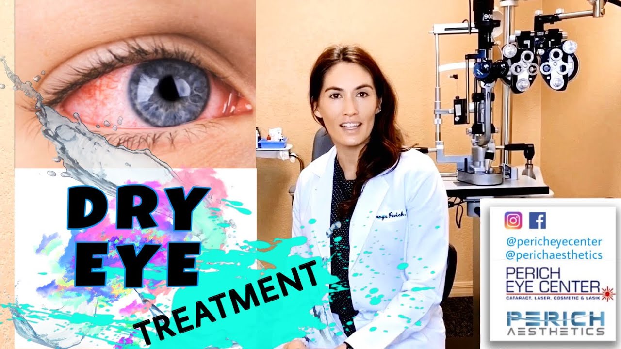 How To Relieve Dry Eye Syndrome What Are Your Options? Eye Care Tampa