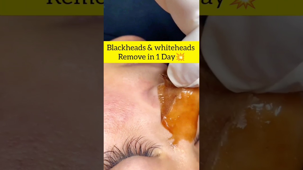 Gelatin🌾Powder🙏🏻Mask🌱|Clean🌷Blackheads🙏🏻| Skincare🍯tips💕