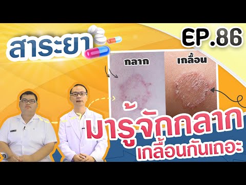 สาระยา | มารู้จักกลาก เกลื้อนกันเถอะ | EP.86