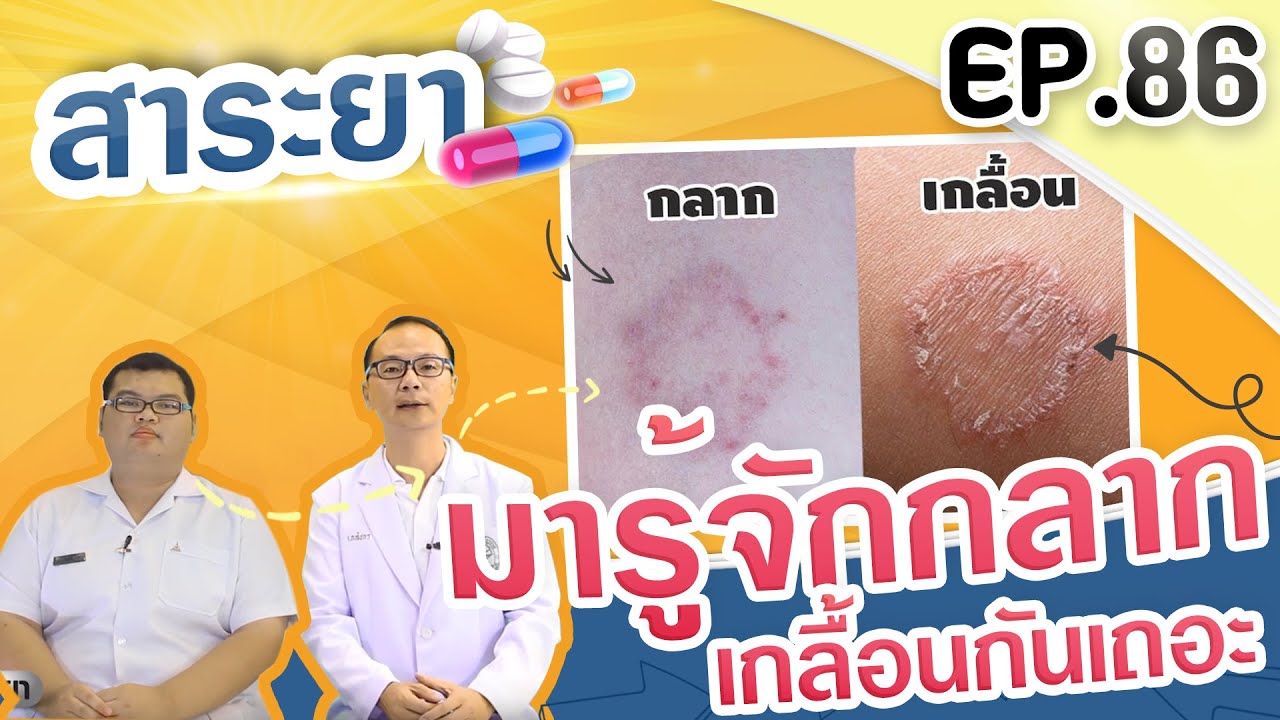 สาระยา | มารู้จักกลาก เกลื้อนกันเถอะ | EP.86 - YouTube สาระยา | มารู้จักกลาก เกลื้อนกันเถอะ | Ep.86 - Youtube