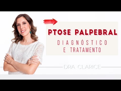 Dra. Clarice Abreu -  Ptose Palpebral