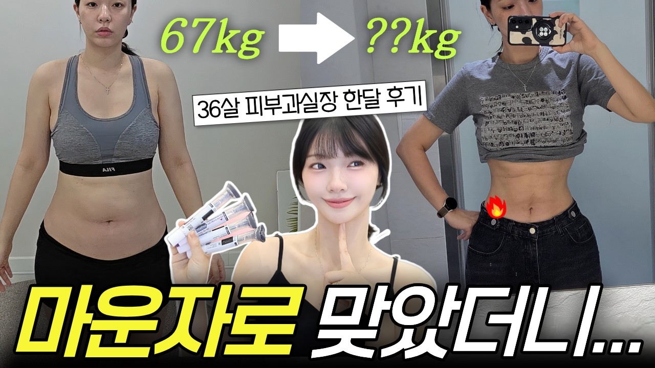 67kg드럼통 뚱녀가 마운자로 한달 맞고 생긴일🔥병원 가기전 꼭보세요⚠️부작용, 사용법, 가격, 맞는법, 장단점까지‼️
