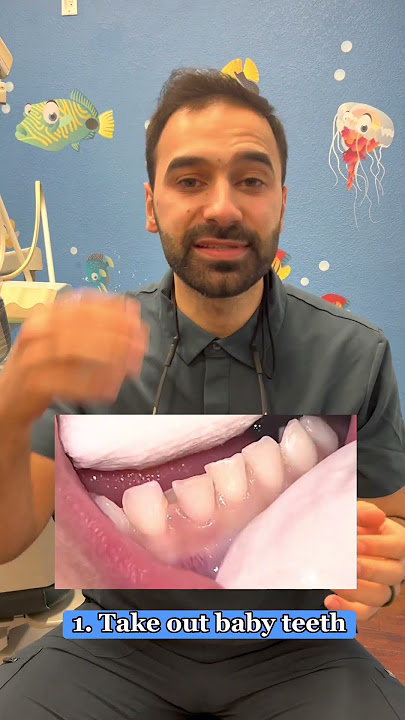 Baby Teeth vs Adult Teeth #shorts