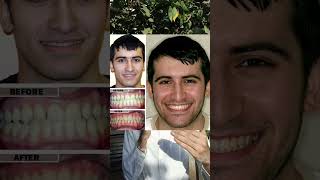 real reason why your face doesn't look good | #looksmaxxing #shorts