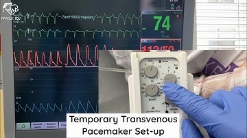 Temporary transvenous pacemeker set-up