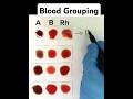 Simplified Blood Grouping Techniques